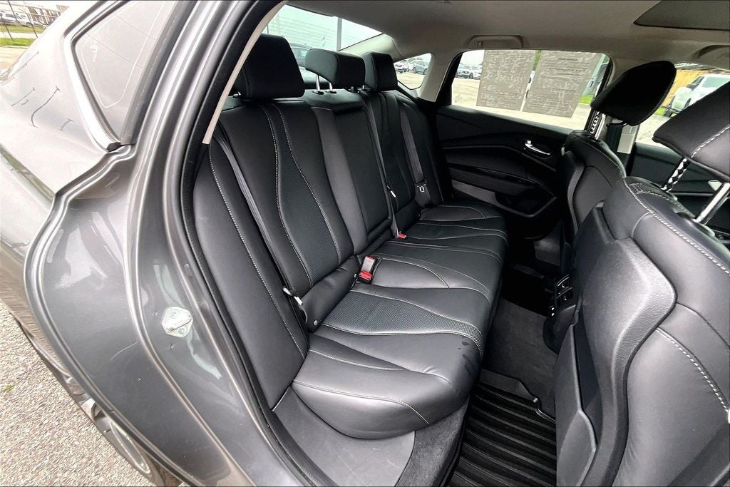 2025 Acura TLX Technology Package