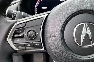 2025 Acura TLX Technology Package